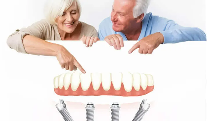 Dental Implants for Seniors: Questions and Answers