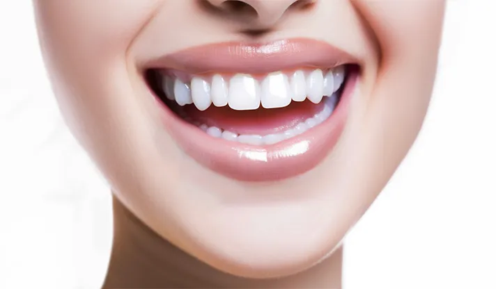 How to Whiten Your Teeth